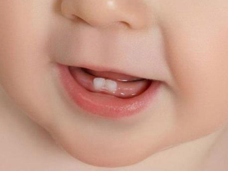 Uşaqlarda diş çıxarma