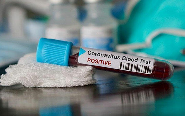 TƏBİB rəsmisindən koronavirusdan ölüm sayı ilə bağlı - Açıqlama