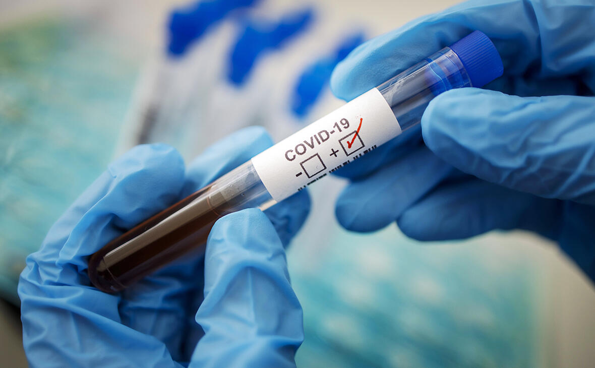 Dünyada ilk - Alimlər koronavirusu təyin edən genetik test hazırladı